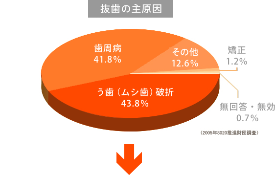 抜歯の主原因